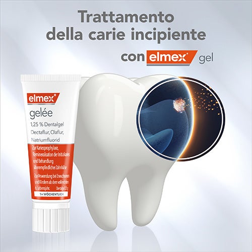 La carie incipiente e reversible con elmex gel